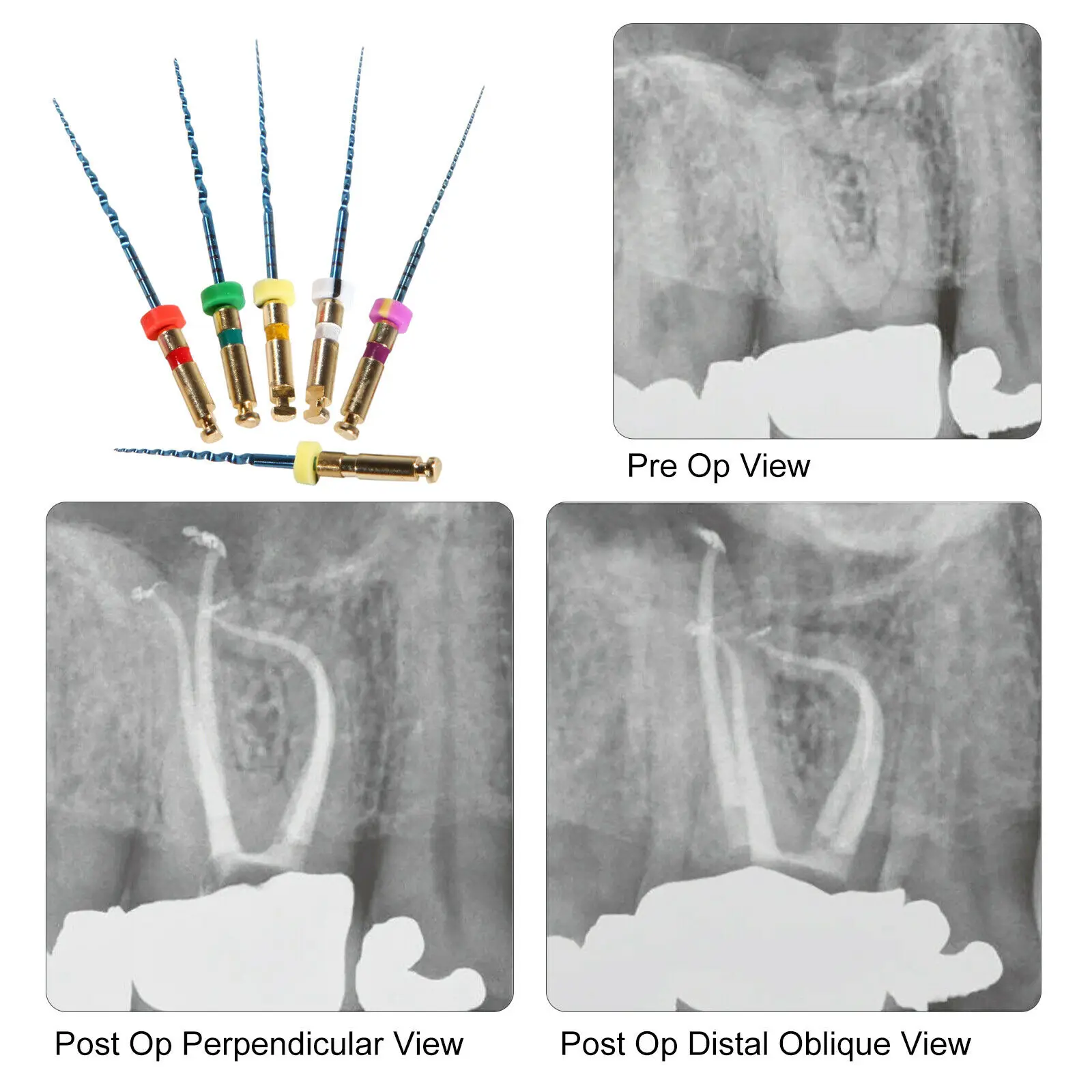 60PCS ทันตกรรม Endo Endodontic Universal Engine โรตารี่เคล็ดลับสารพัน Root Canal NiTi แฟ้ม21มม.