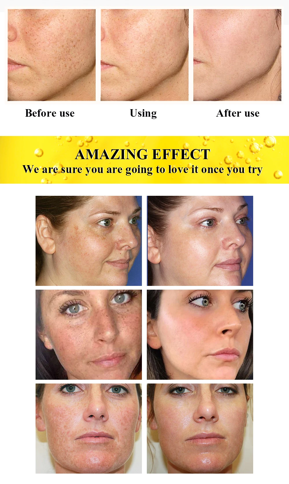 AILKE Superior Lighten Vitamin C Face Serum, Moisturizes, Hydration, Remove Hyperpigmentation, Black Spots, Freckles, Clean Skin