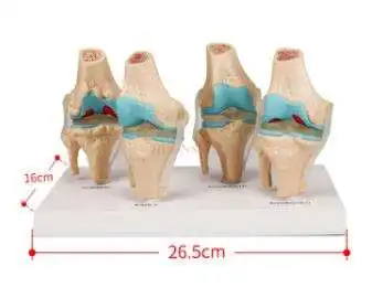 

Human knee degeneration / lesion demonstration model Skeletal model Functional human joint model
