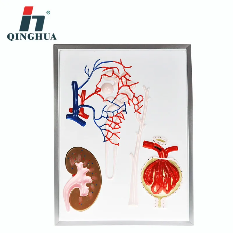 

Nephron Renal Corpuscle Scale-up Model Human Realistic Renal Anatomical Structure Biomedical Science Demonstration Teaching Aids