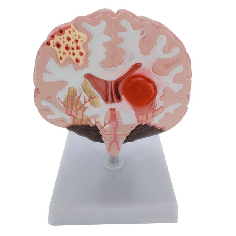 

2023 New Human Brain Model Brain Anatomical Model with Cerebral Cortex Brain Stem Arteries Etc for education Lectures Use