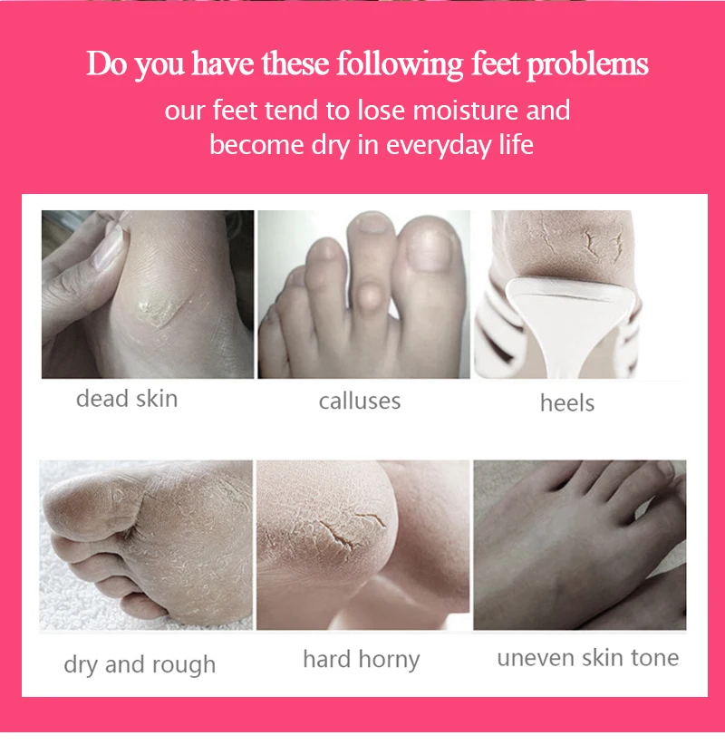 30pairs Exfoliating Foot Masks Pedicure Socks Strawberry Milk Exfoliation for Feet Mask Remove Dead Skin Heels Foot Peeling Mask