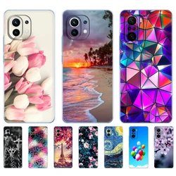 For xiaomi Mi 11 | Mi 11 Lite 4G 5G NE| Mi 11i | Mi 11 Ultra Case Back xiaomi11 i 11Lite Phone Cover Xiomi Mi11Lite Silicon TPU