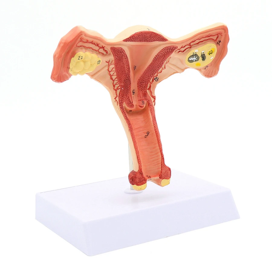 

Female Uterus Ovary Model Female Genital Anatomy Model Medical Teaching Model