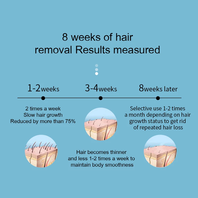 جهاز إزالة الشعر IPL الاحترافي للنساء ، جهاز إزالة الشعر الكهربائي ، جهاز إزالة الشعر النبضي ، جهاز إزالة الشعر الضوئي للوجه والجسم ، أنثى