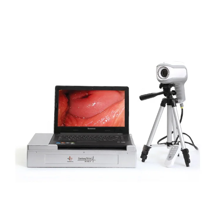 China manufacturers medical video colposcope portable machines portable digital colposcope for gynecology