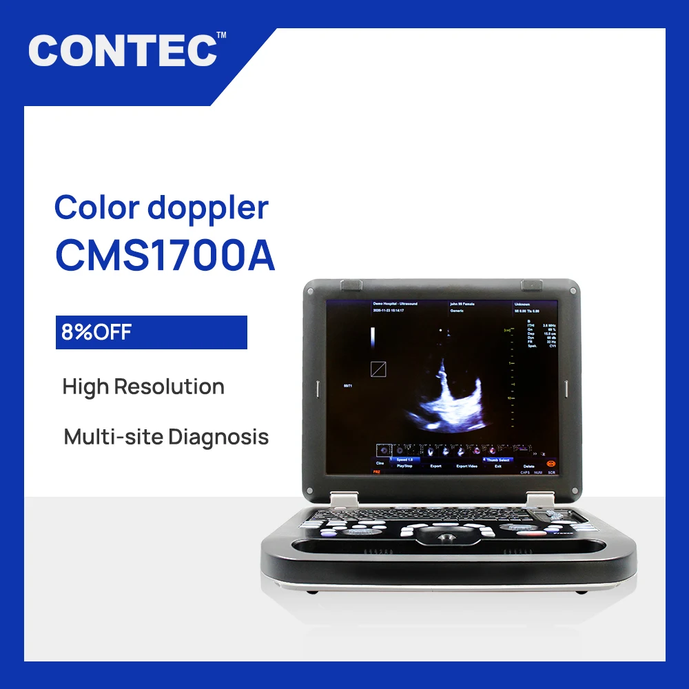 Portable Color Doppler CONTEC CMS1700A CMS1700B CMS1700C Ultrasound Scanner Machine+ convex Probe 2021 newest