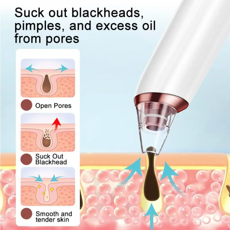 الوجه البثرة مزيل الكهربائية حب الشباب الأنظف البثرة نقطة سوداء فراغ أداة تنظيف البقع السوداء المسام الأنظف