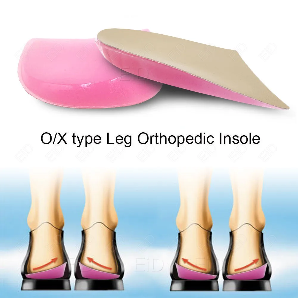 XO – semelles orthopédiques en Silicone pour jambes, Support d'arc, correcteur de pied plat, coussin d'insertion de Gel, coussinets orthopédiques à talons hauts