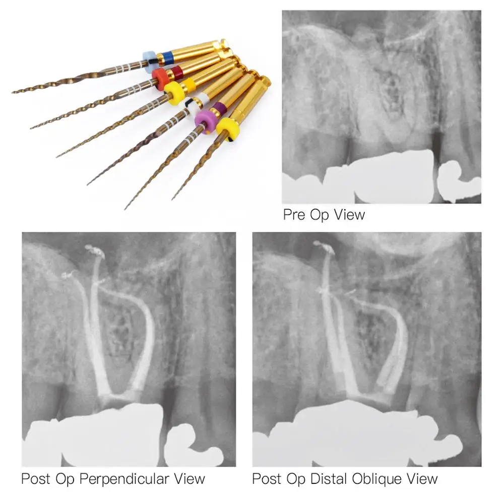 3 paczki dentystyczne endodontyczne złote stożek NITI obrotowe pilniki silnika wykorzystują rozszerzenie 25mm,SX-F3