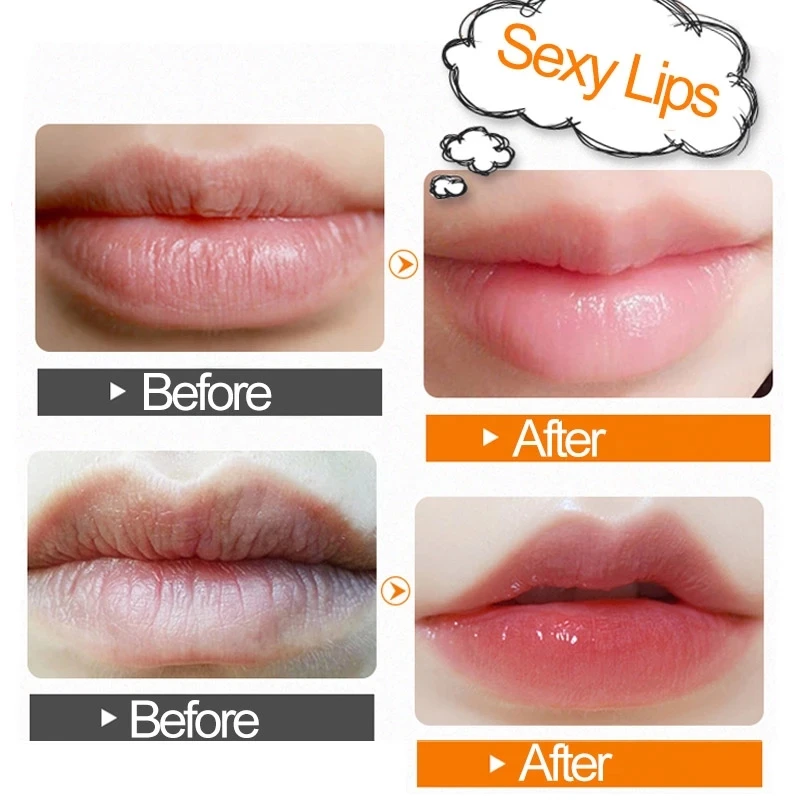 10Pcs Strawberry ​Lips Mask Natural Fruit Collagen Nourishing Moisturizing Repairing Tender Sexy Lips Prevent Chapped Lips Care