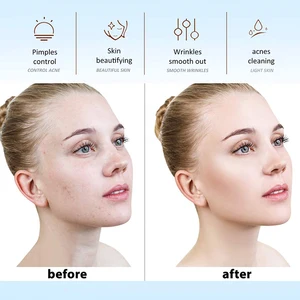 Hochfrequenzgesichtsmaschine, Hauttherapie, Elektrode, Zauberstab, Neonelektriotherapie, Glasrohr, Akne -Fleckenentferner, Hautpflegevorrichtung vom Gesicht 8 Hauptverkaufsweg Anti -Aging - №8