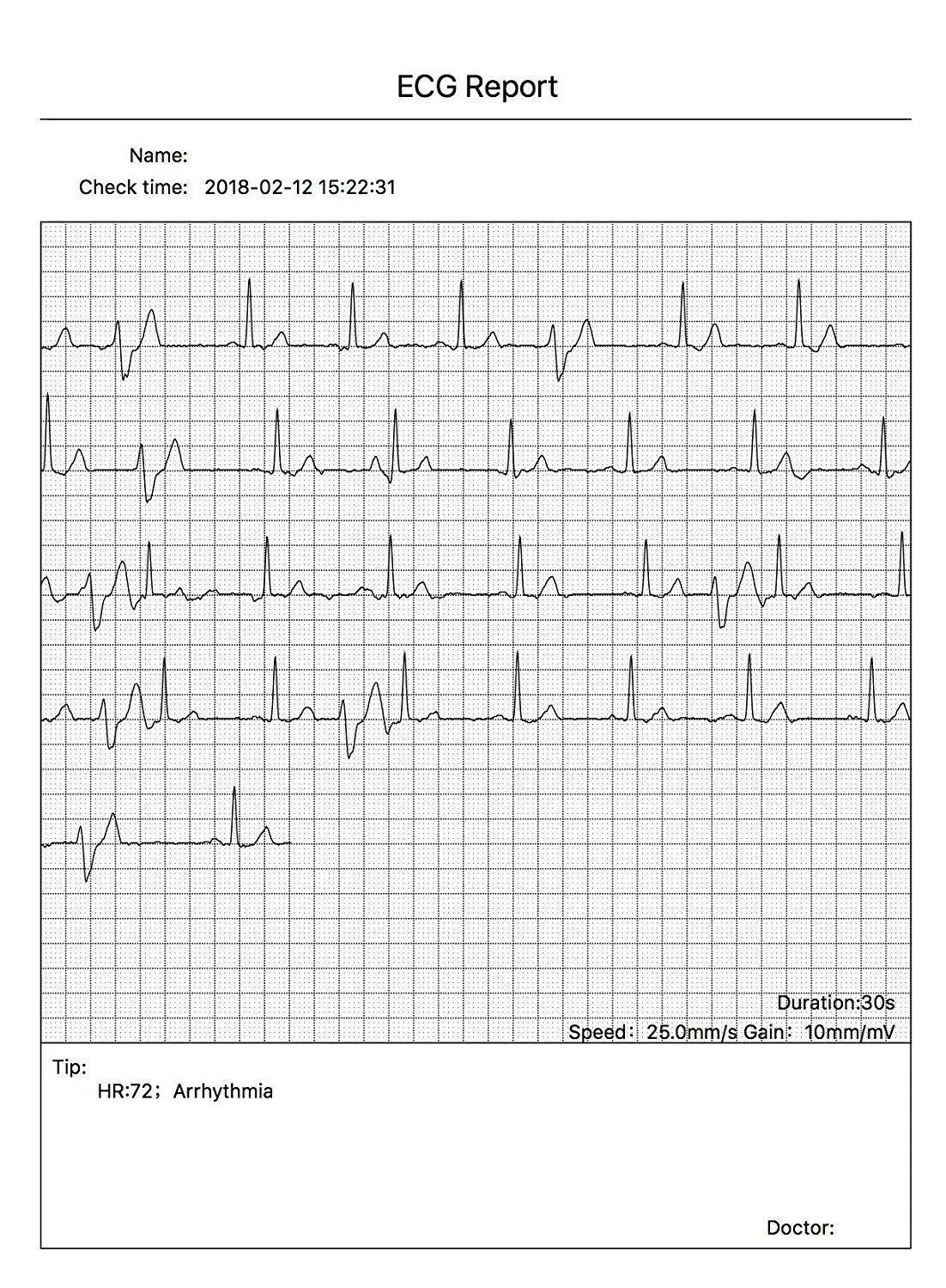 CONTEC PM10 Bluetooth Handheld Portable ECG EKG Machine Heart Beat Monitor LCD USB Software