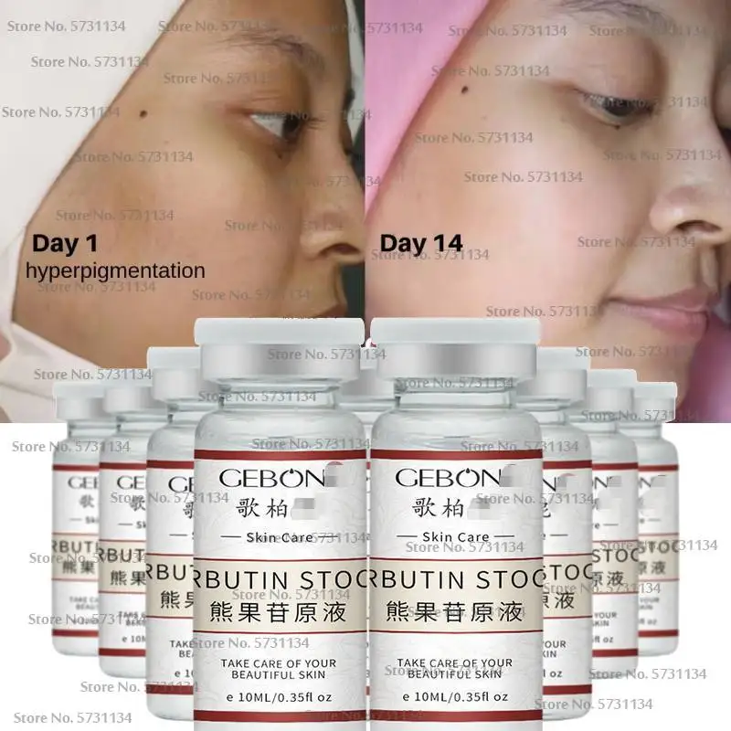 Intensive Alpha arbutin Booster Serum bleaching Aufhellung Dunkle flecken MIX Creme Körper Lotion