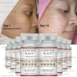 Intensive Alpha arbutin Booster Serum whitening Lightening Dark spots MIX Cream Body Lotion