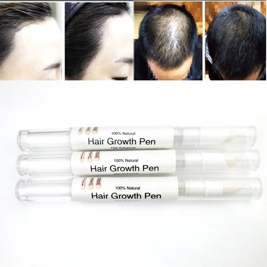 Natural Faster Grow 5% Mino Hair Growth Regrowth Oil Tonic Serum Products Rajout Cheveux Cure Products Stop Hair Loss Treatment