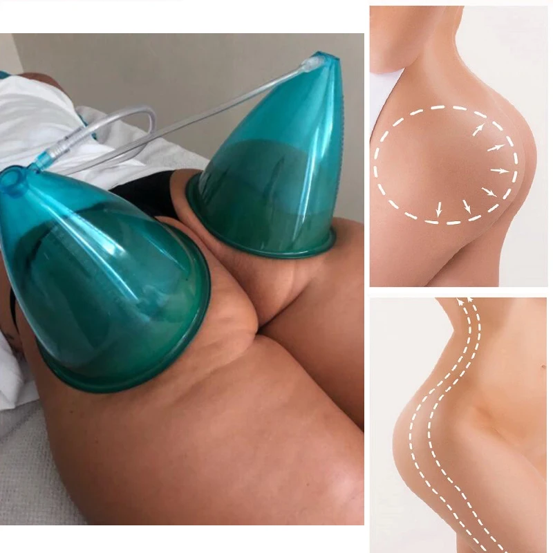 Electric Breast Pumps big 18cm Cup Buttock Breast Enlargement Vacuum Suction Device Colombian lifting For Female Pump