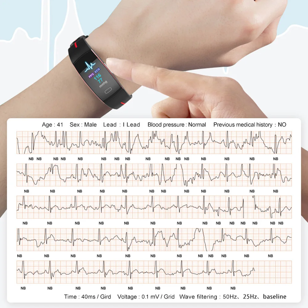 Pulsera inteligente ECG PPG para hombre, reloj deportivo resistente al agua IP67, control de temperatura corporal, presión arterial, oxígeno, Fitness