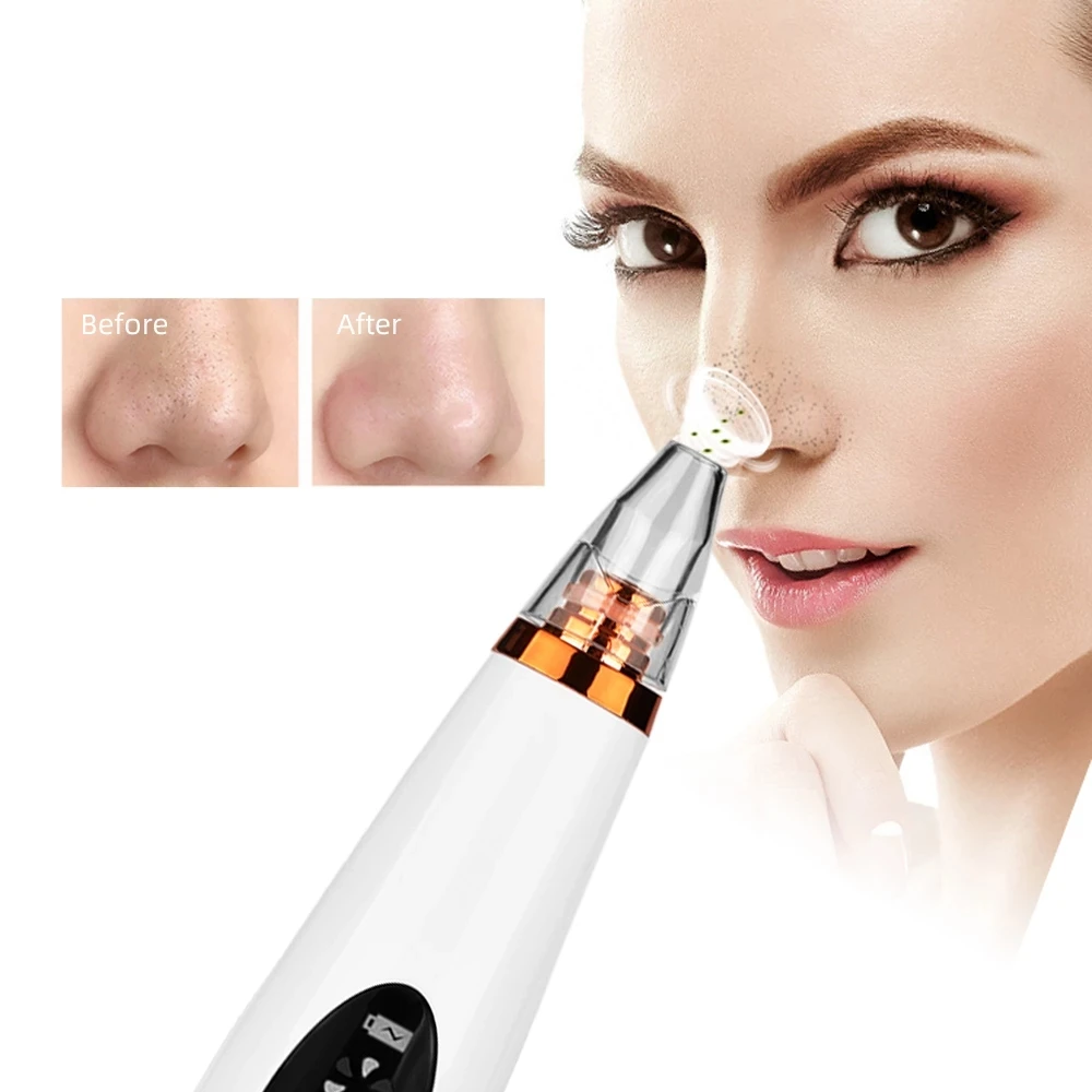 

Blackhead Remover Vacuum Suction Cleaner Nose Facial Pore Cleaner Spot Acne Black Head Pimple Removal Beauty Face Skin Care Tool