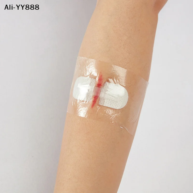 

【Y88】【Z】Sterile Strip Scar Away Acne Scar Marks Remover Sterile First Aid Travel Wound Skin Closures Medical Surgical Adhesive