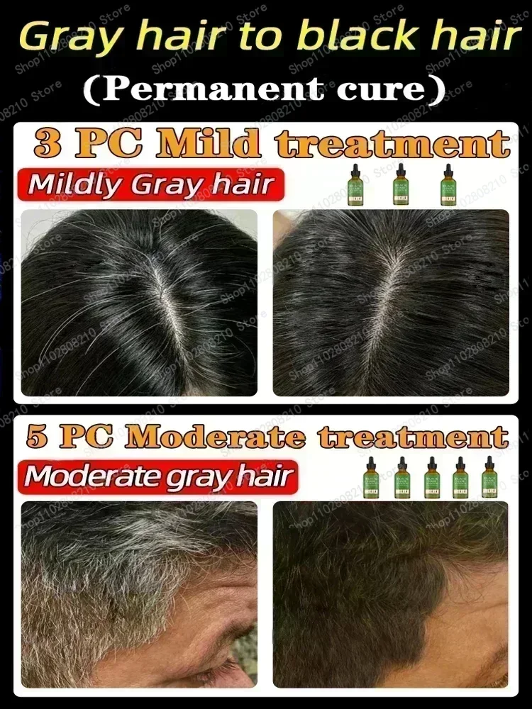 Grey Coverage Bar Shampoo Repair Gray Natural Anti-Grey Hair Essence Serum Smoothing Nourishing Dandruff Natural Darkening Soap1