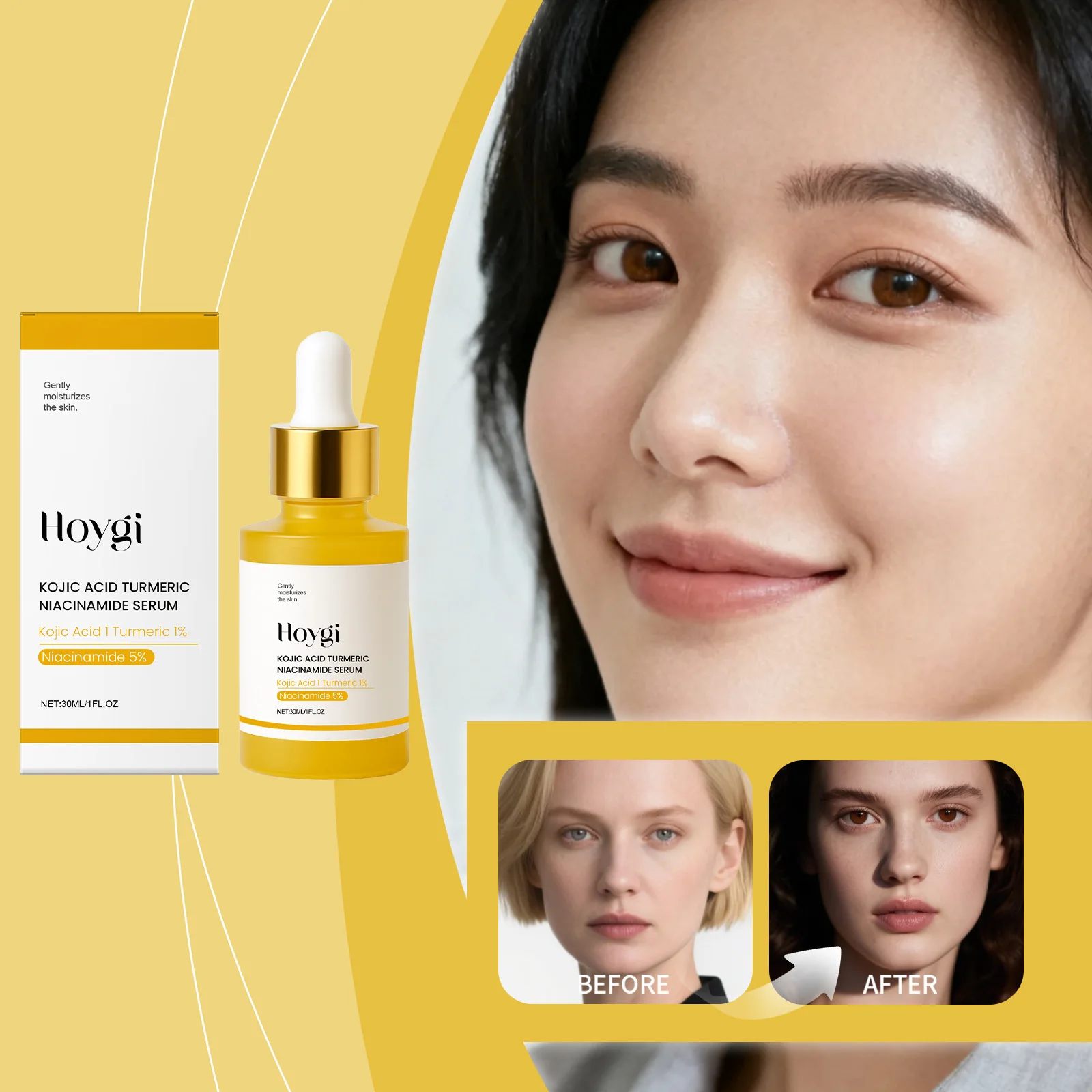 ホイギ5%ナイアシンアミドセラム（コウジ酸＆ターメリック配合）保湿・滑らか肌ケア、保湿弾力肌へ