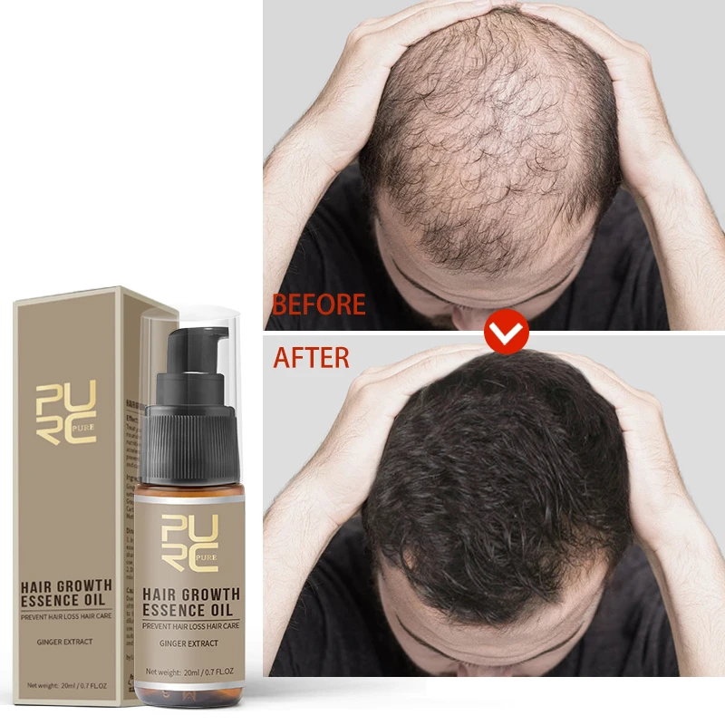 Scalp Promotes Hair Growth Suitable For All Hair Types Rejuvenating Phenomenal Nourishing Revolutionary Men Women