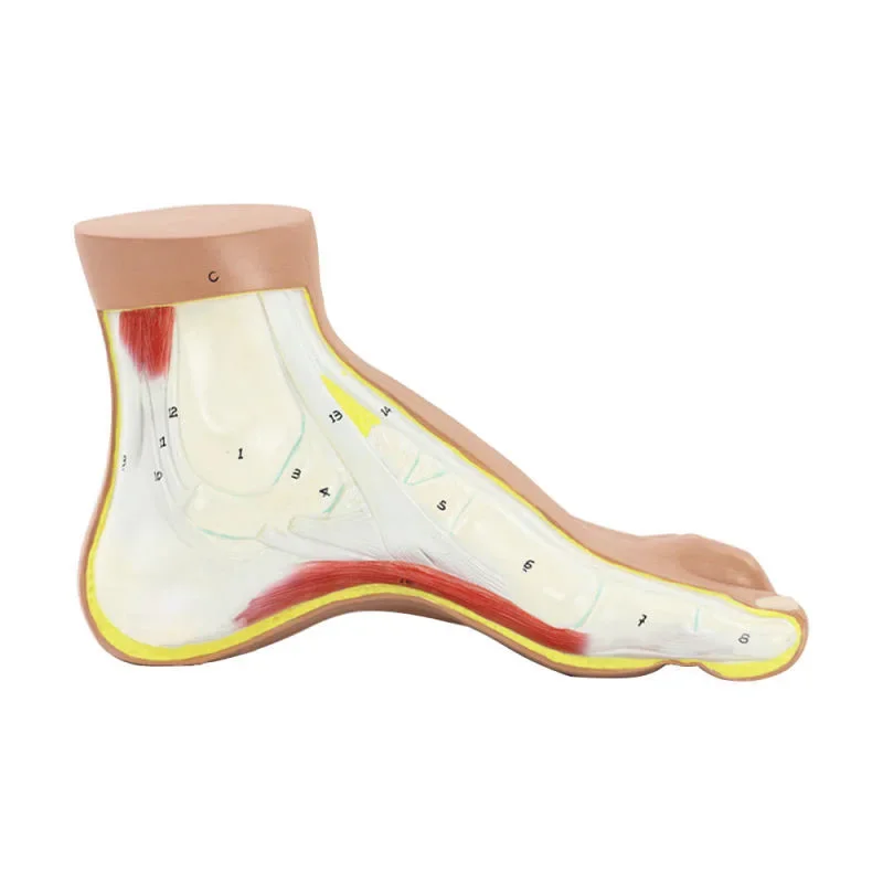 

Arched Foot High Arched Foot Claw Shaped Foot Joint Anatomy Model Medical Teaching