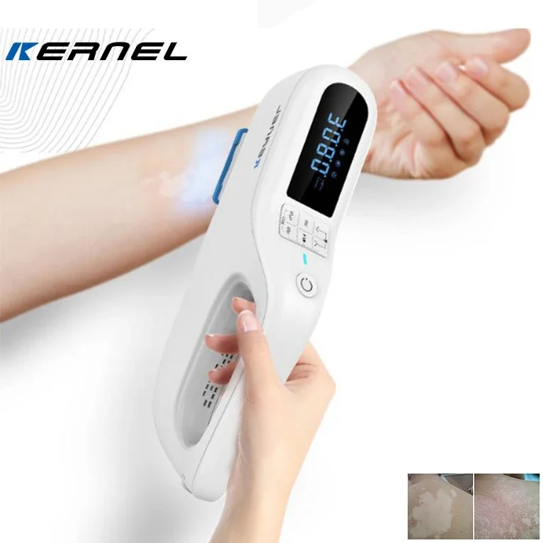 308nm excimer laser vitiligo phototherapy instrument genuine home medical UVB UV treatment instrument 308 excimer laser vitiligo