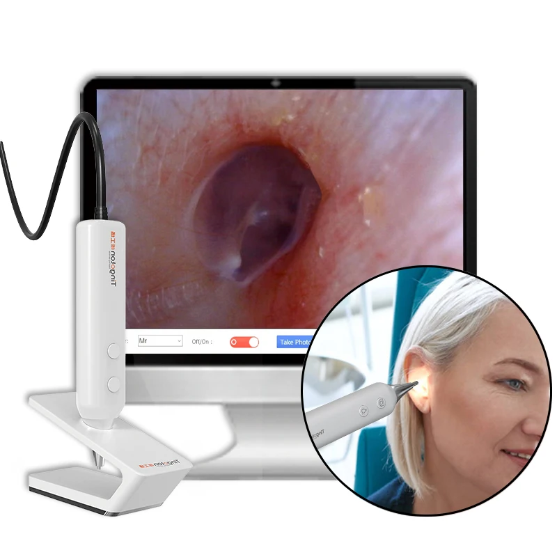 

New Model Best Price High-quality Oem Inspection Otoscope Ear Endoscope cameera