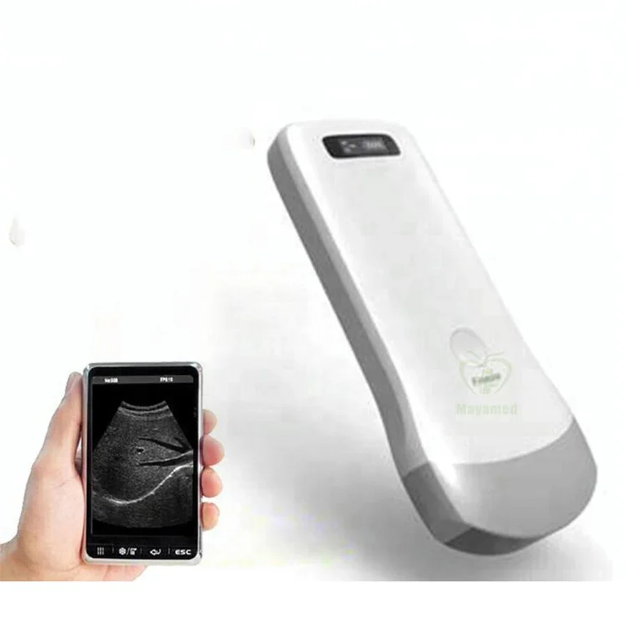 MY-A010B Professional Medical handheld Ultrasound scanner wireless ultrasound probe