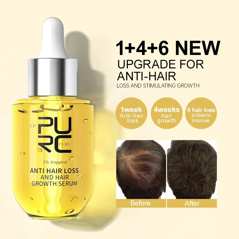 

PURC Anti Hair Loss Serum Hair Growth Serum Ginger Grow Repair Hair Care Oil Scalp Serum Fast Regrowth Thicken for Men Women