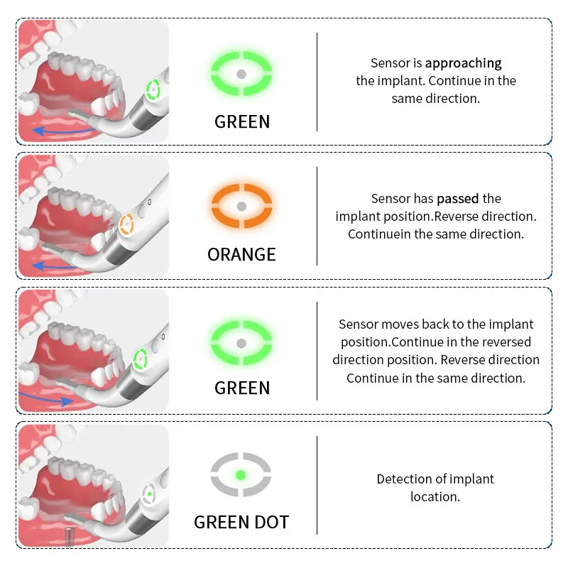 Detektor pengintai implan gigi, pencari lokasi gigi 3D Smart Locator 360 derajat kepala untuk bedah