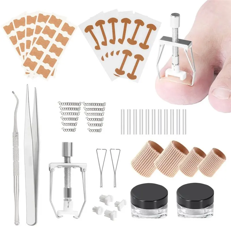 【FAVORITE】Professional Ingrown Toenail Treatment Removal Kit Ingrown Toenail Corrector, Tweezers Set Included