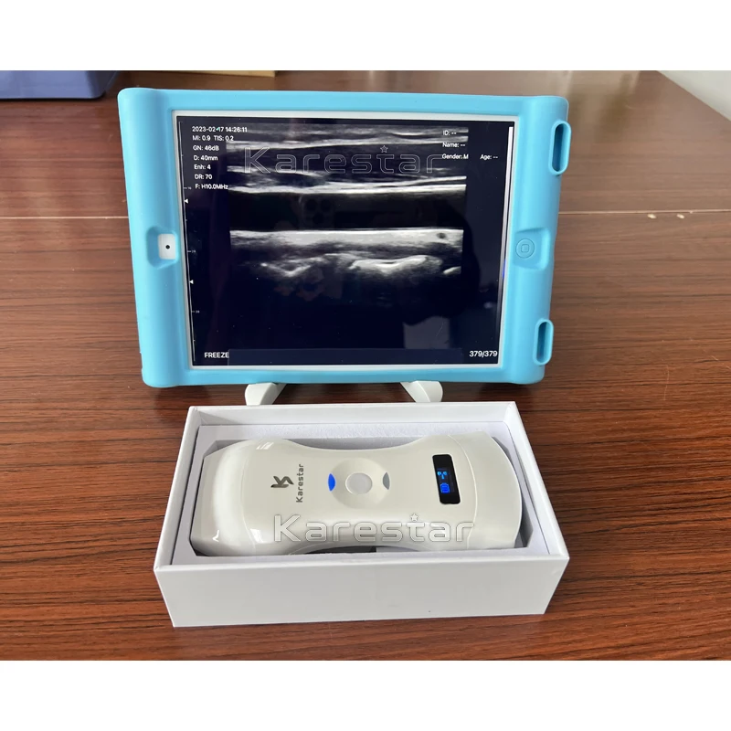 K-TC101 veterinary machine portable medical ultrasound instruments Super clear image 3 in 1 wireless wifi ultrasound