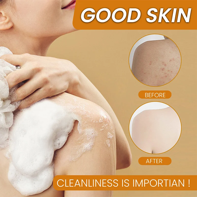 Ginger Lemon Kojic Acid Bath Soap Facial Soap Skin Care Cleaning Care Effective Cleaning Rich Foam Brighten Revitalize The Skin