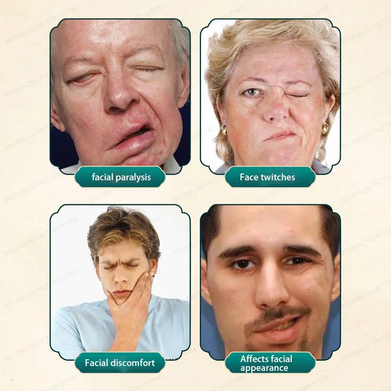 顔のようなしびれ、顔面麻痺軟膏、顔面イガイヘルスケア軟膏、顔面麻痺、血中血栓症後、口と目のしびれ矯正軟膏、足の曲がり、手足のしびれ