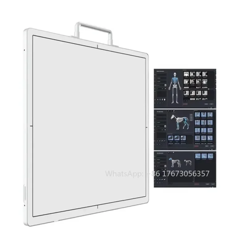 DKFP01 17*17 Wireless Portable Flat Panel X Ray Detector Dr X-ray Flat Panel Detector with Software for Humans Veterinary Use