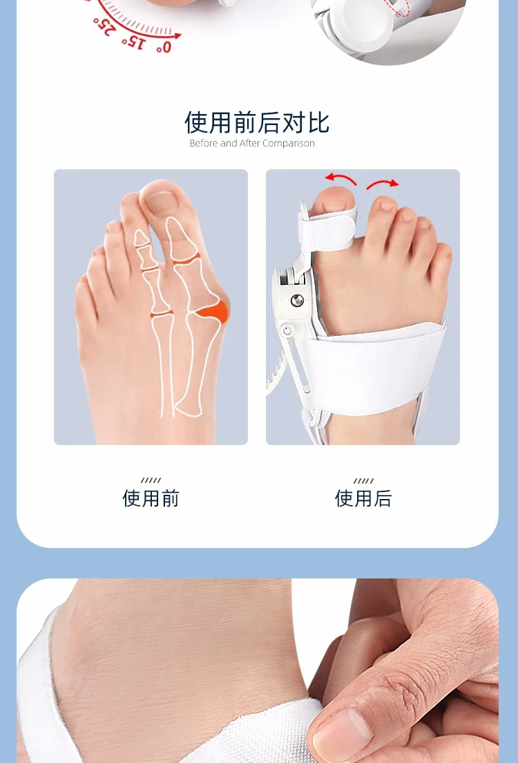 Hallux-Valgus-Korrektor für Zehenspreizer, Zehentrenner, Fußpflege, Bunion-Korrektor – Detail 7