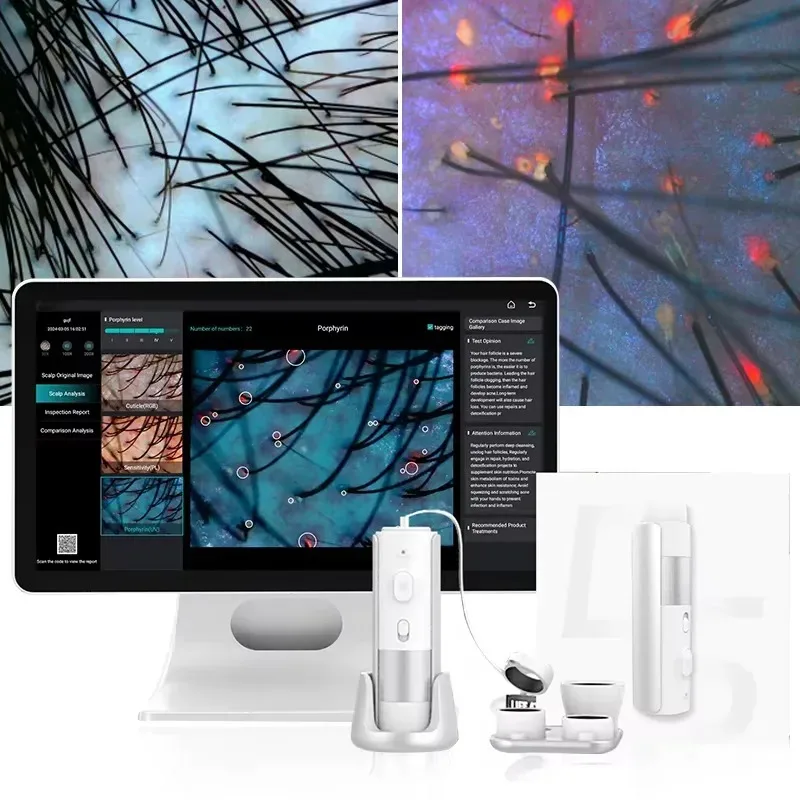 

2025 New High-Quality HD Hair Follicle Scalp Scanner & Hair Analyzer Skin and Scalp Analysis Machine