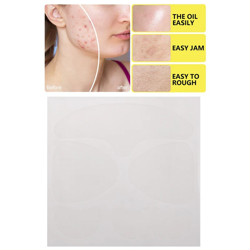 5Pcs/set Full Face Pimple Patches Large Hydrocolloid Patch Acne Removal Face Skin Cleaning For Nose Chin Forehead Cheek