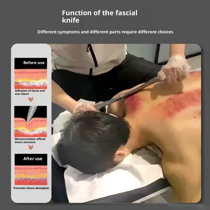 

1PC Gua Sha Scraping Massage Tool For Large Muscles Soft Tissue Mobilization 304 Stainless Steel Fascia Knife M Guasha Therapy