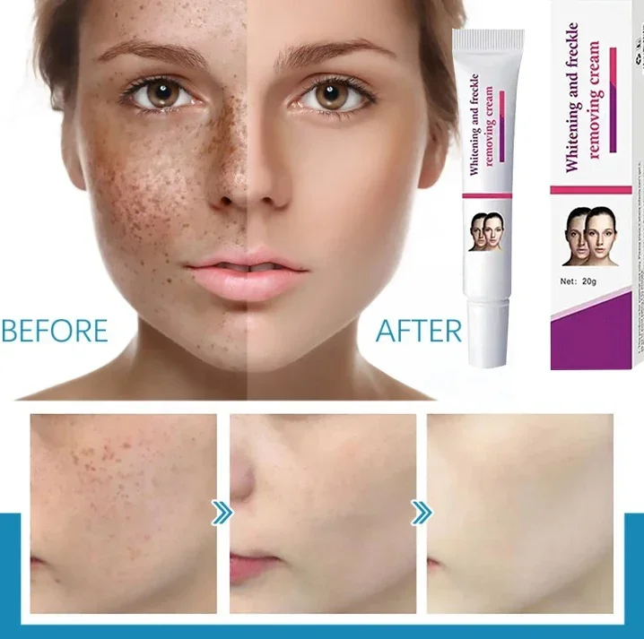 

Facial Whitening Cream Removes Melanin Age Spots And Freckles Reduces Dullness Moisturizes Brightens Facial Care