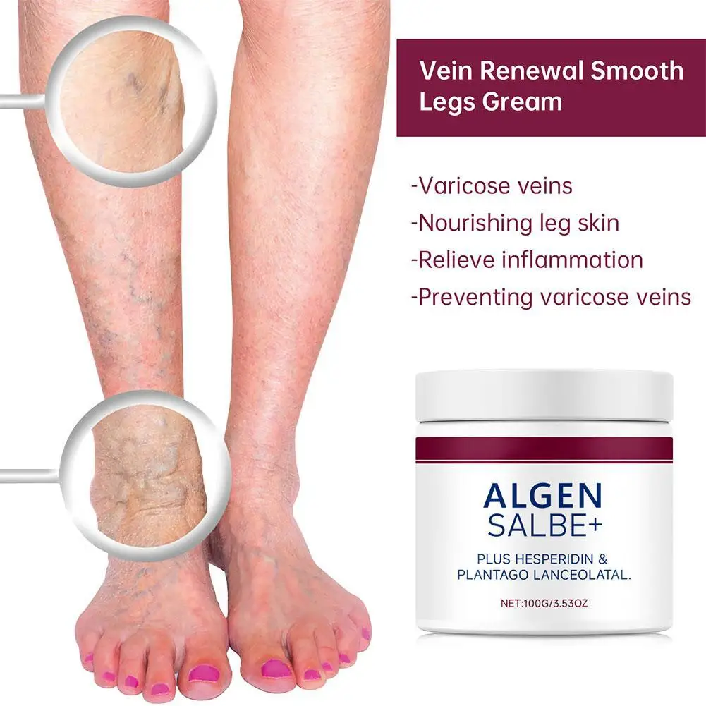 100g Varicose Vein Repair Cream Tongmai Effective Relieves Leg Bulge Pain Treatment Cream Vasculitis Phlebitis Remove Vein