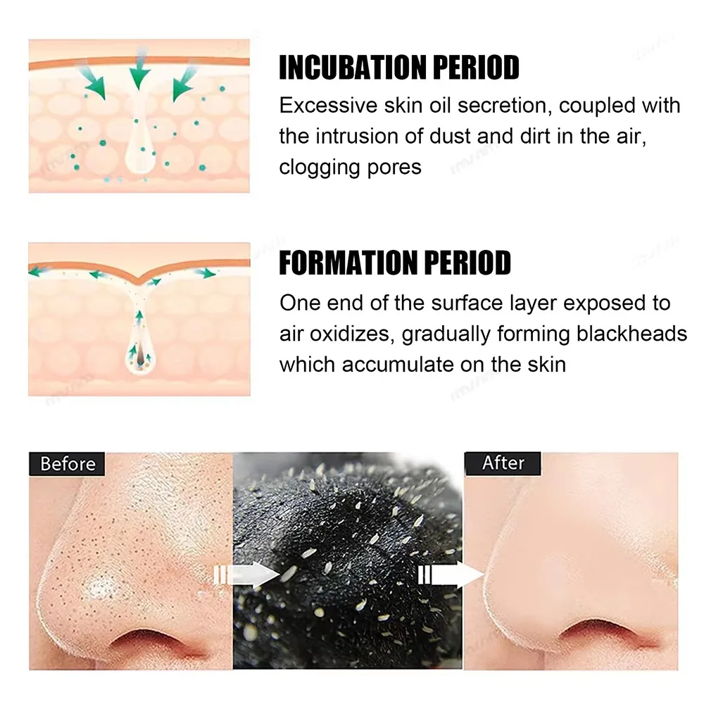 Autocollants pour points noirs au charbon de bambou, 20 pièces, soins de nettoyage en profondeur du nez, Film pour enlever les points noirs, absorbe l'huile, bâton pour le nez