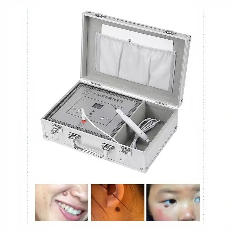 1 Set 220V Professional Electronic Spot Scanner Dead Skin Removal Skincare Beauty Tool for Home & Salon