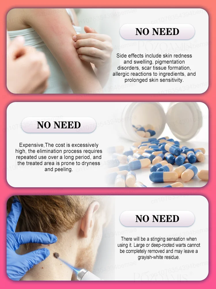 ʙʟᴜᴇ ʟɪɢʜᴛ ᴘᴇɴ sᴏʟᴠᴇ ᴡᴀʀᴛs, ʜᴏᴛ sᴀʟᴇ ᴡᴀʀᴛ ᴄᴀʀᴇ ᴛᴏᴏʟs