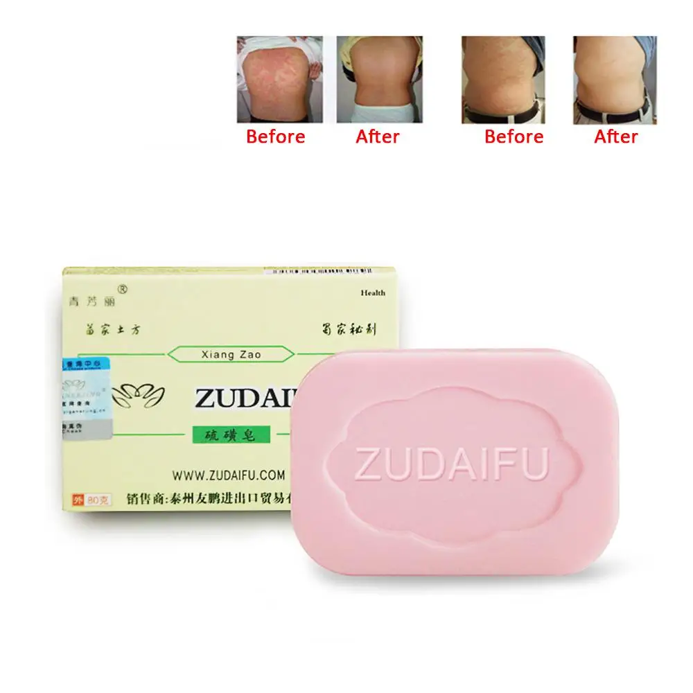 1~10PCS Zudaifu Sulfur Soap Cleanser Oil-Control Cure Face Whitening Sulfur Soap Skin Peel Cleanser Handmade Soap