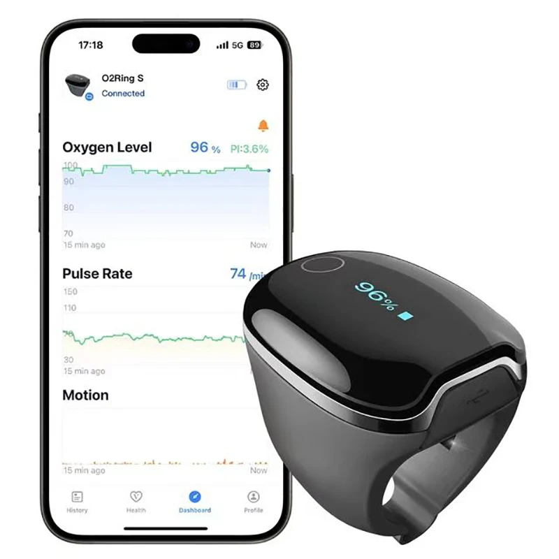 Bluetooth Wearable Sleep Oximeter Monitor Overnight Continuous Supervision Up To 15 Hours Hypoxia Alarm Reminder Data Report