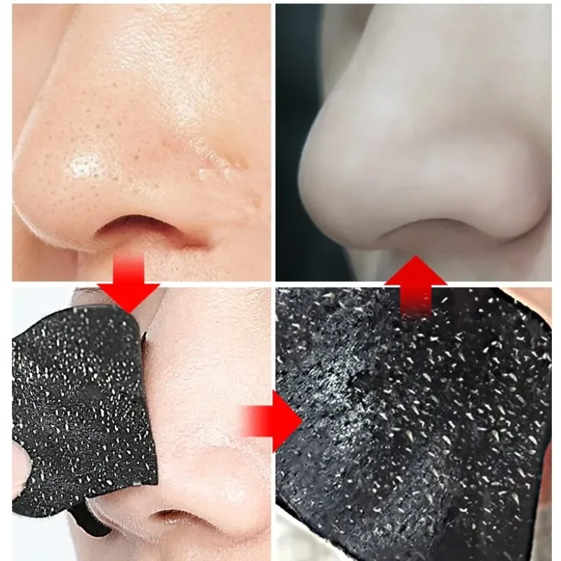 10/50pcs Nose Blackhead Remover Mask Pore Cleaner Acne Treatment Mask Deep Nose Pore Cleasing Strips Black Head Remover Tool